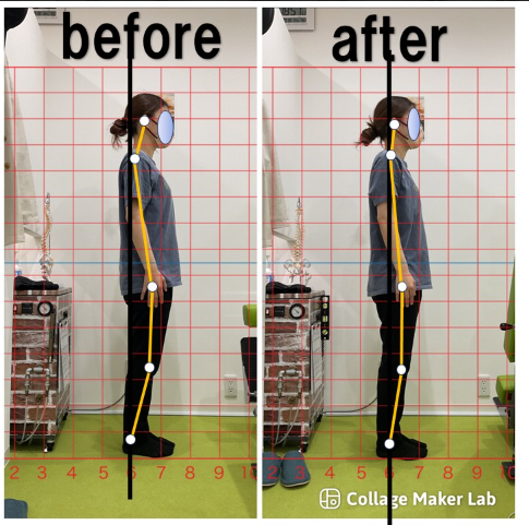 ビフォーアフター