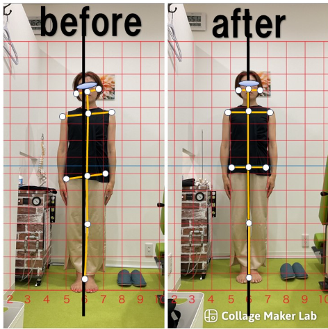 ビフォーアフター