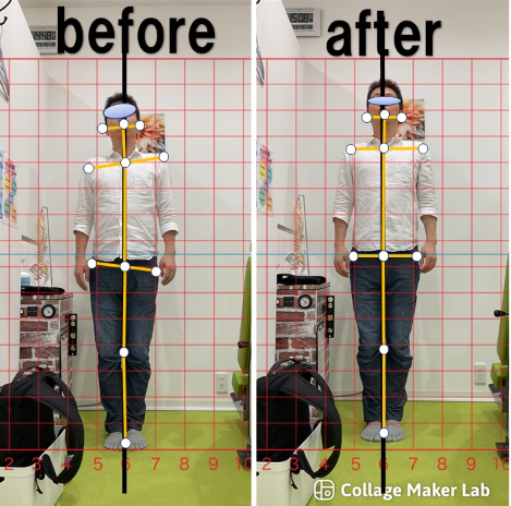 ビフォーアフター